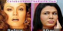 Image result for Rakhi Sawant Before and After Surgery. Size: 217 x 108. Source: www.pinterest.com