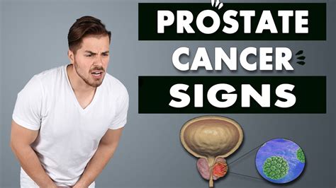 what are the causes of prostate cancer men s health prostate cancer