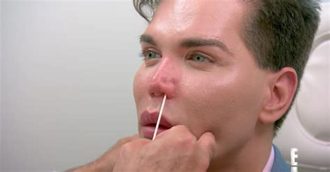 botched season 4 dr paul nassif tells patient his nose could ‘die and