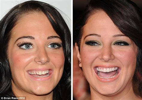 Stars Who Ve Brushed Up Their Smiles Image With Gleaming New Teeth