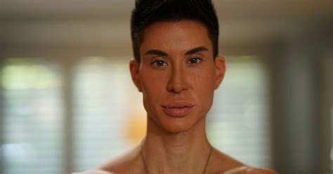 Surgery Obsessed Human Ken Doll Pays £16 000 For Bizarre Implants In