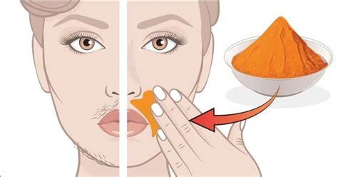Remove Upper Lip Hair Forever With Just Two Ingredients