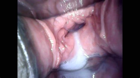 Speculum Observation During Continuous Vaginal Creampie Xhamster