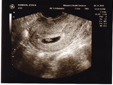 four weeks pregnant ultrasound kamasutra porn videos