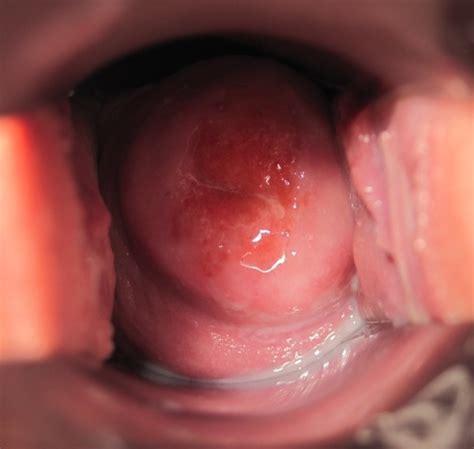 beautiful cervix mega porn pics