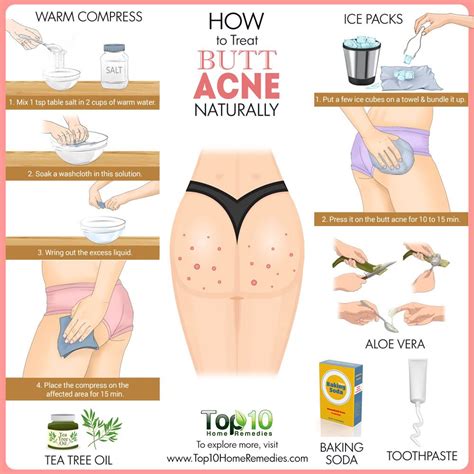 How To Treat Butt Acne Naturally Top 10 Home Remedies