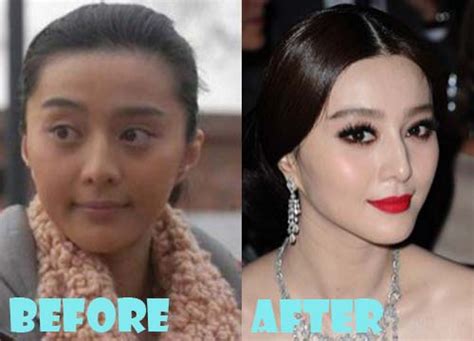 Fan Bingbing Plastic Surgery Before And After Photos Lovely Surgery