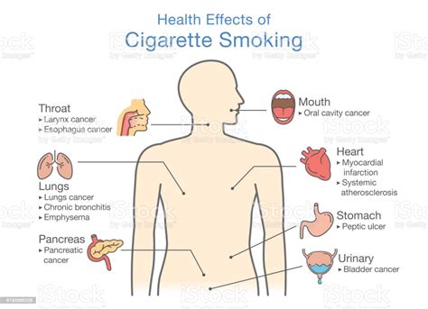 Diagram About Health Effect Of Cigarette Smoking Stock
