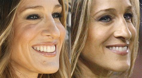 Sarah Jessica Parker Has Mole Removed Report Nz