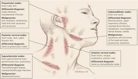Cervical Lymphadenopathy Causes Diagnosis And Treatment