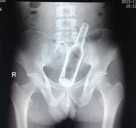 13 of the weirdest x ray pictures ever the sun