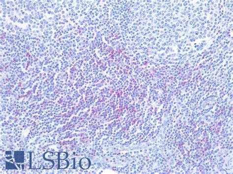 Pathplus™ Cd8a Cd8 Alpha Polyclonal Antibody Rabbit Ihc Lsbio