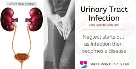 Honeymooners Disease Urinary Tract Infection Captions Imajinative
