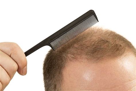common scalp problems   treatments