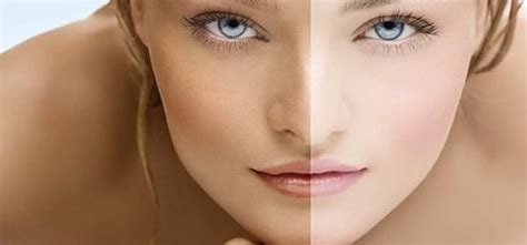 lighten skin naturally  permanently