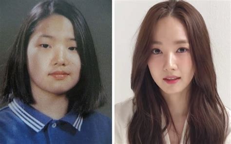 korean actresses bravely admitted    plastic surgery