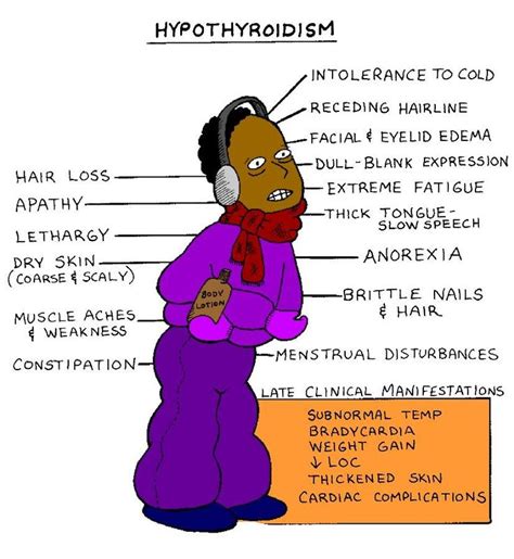 39 best images about hypothyroidism on pinterest underactive thyroid