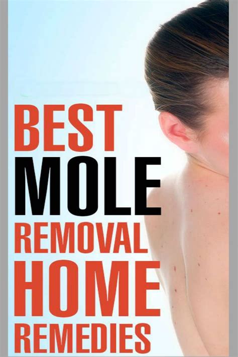 home remedies for moles skin moles skin tag removal cream skin tag
