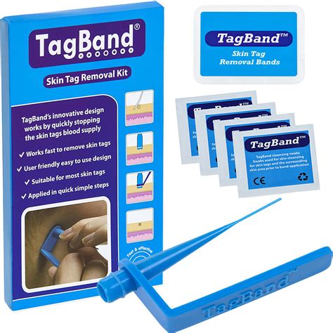 tagband skin tag remover device for a fast and effective