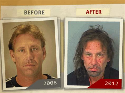 Photos Before And After Faces Of Addiction Pictures Show Impact Of