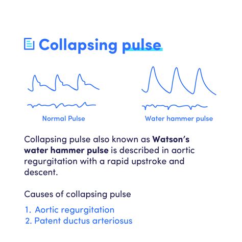 medimagic water hammer pulse   physical exam finding facebook