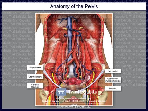 Anatomy Of The Pelvis With Fibroids Trialexhibits Inc
