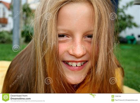 braces and hair stock images image 1330794