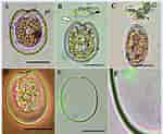 Afbeeldingsresultaten voor "prorocentrum Foraminosum". Grootte: 150 x 123. Bron: www.researchgate.net