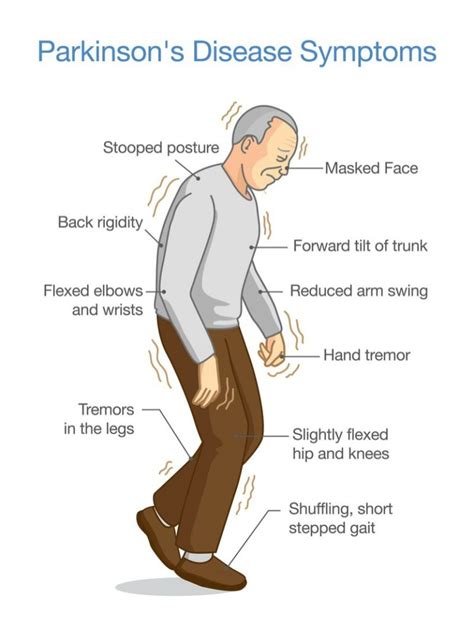 stages  parkinsons disease livewell private care