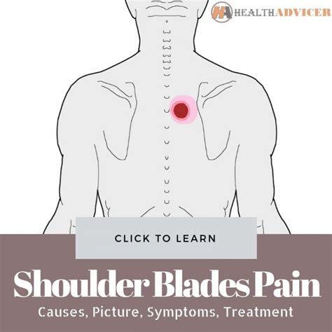 pain  shoulder blades symptoms diagnosis  treatment