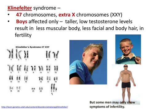 3 X Chromosomes Disorder