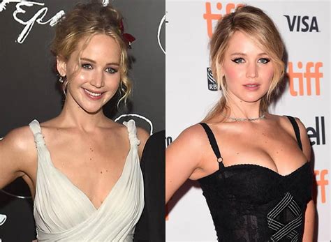 Jennifer Lawrence Is Hot Because Of Plastic Surgery
