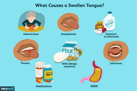 swollen tongue  symptoms  typical remedies