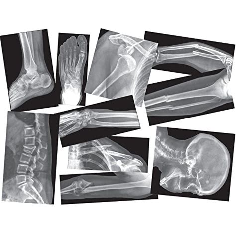 Top 10 Best Fake X Ray 2022 Review And Buying Guide Satplus