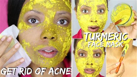 diy turmeric face mask      acne treatment  fight acne