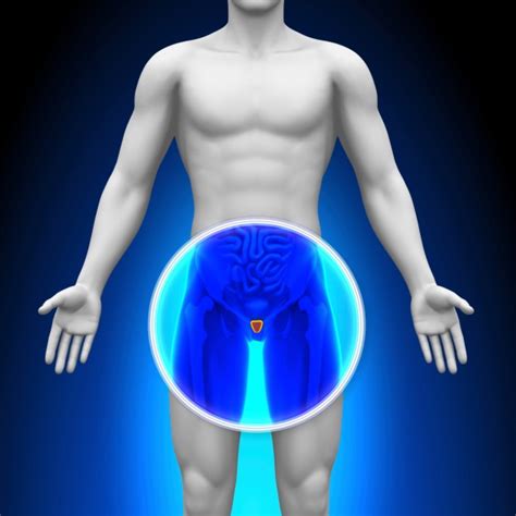cryotherapy is a viable choice for high grade prostate cancer renal and urology news