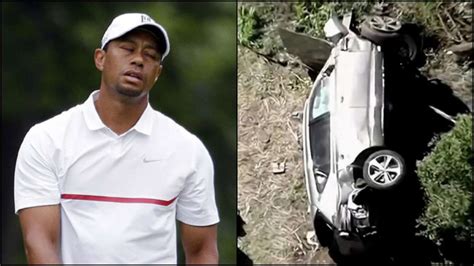Golf Great Tiger Woods Suffers Leg Injuries In Car Crash Dubai My Xxx