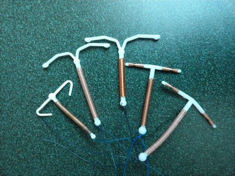 iud insertion information  clinicians willow clinic