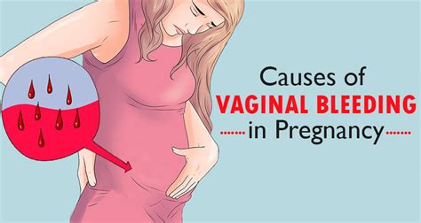 vaginal bleeding and spotting during pregnancy what it means