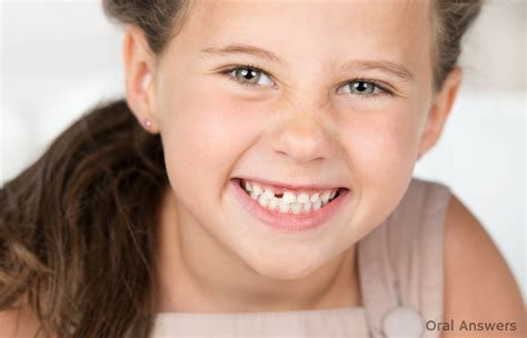 congenitally missing teeth       treat  oral answers
