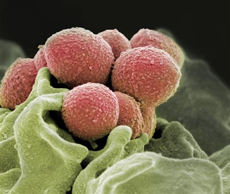discovery reveals antibiotic resistant strep throat    close  comfort
