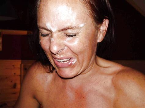 035 1000 in gallery unwanted facials picture 11