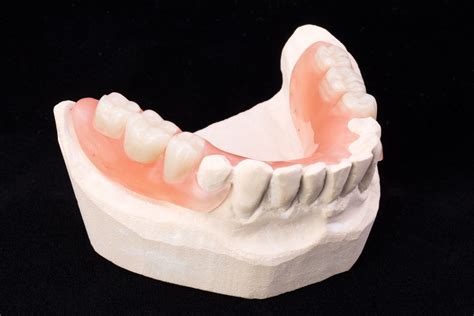 richfield dentist      partial dentures