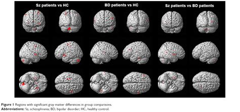 [full text] differences in gray matter volume