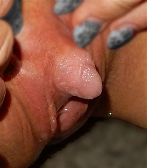 free engorged clitoris pics