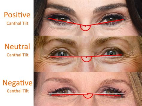 eye canthal tilt    positive tilt  attractive   negative tilt