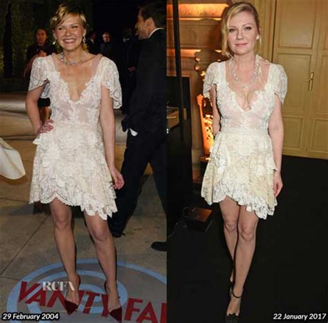 Kirsten Dunst Plastic Surgery Boob Job Before And After