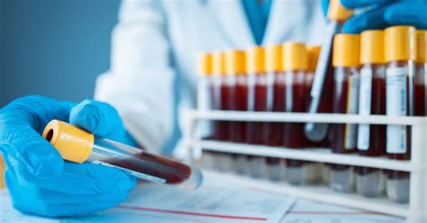 accurate  routine laboratory tests  diagnosis  covid