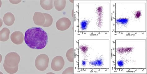 utility  peripheral blood smear review  identifying specimens