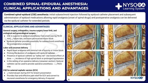 combined spinal epidural anesthesia application advantages nysora